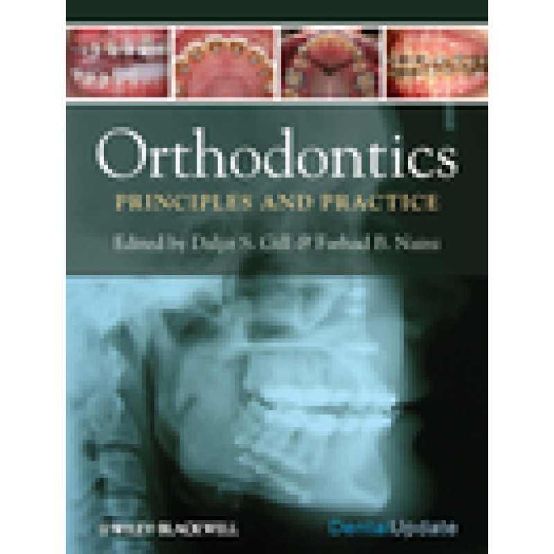 Orthodontics: Principles and Practice